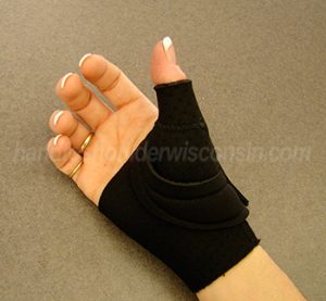 A prefabricated splint is used to alleviate pain for thumb arthritis