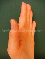 Tendon glide hand exercise