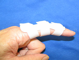Finger splint