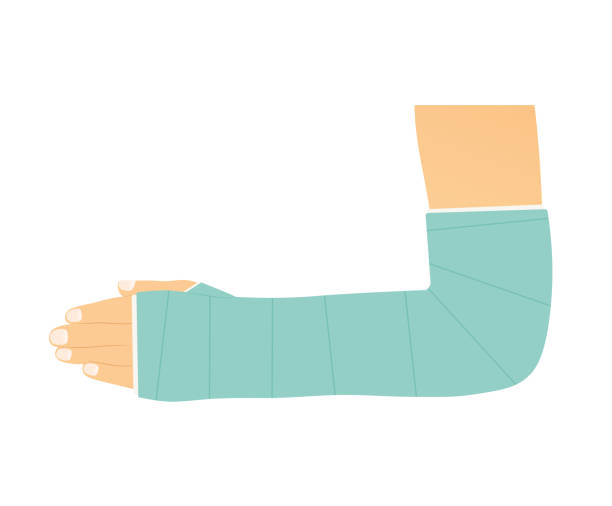Hand In Cast Hand to ShoulderEducational Resources - Hand to Shoulder